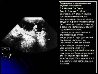 сердце сердце