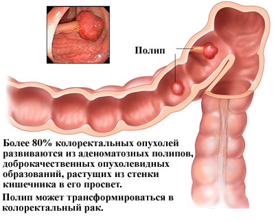диабет диабет