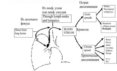 туберкулез