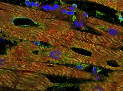 Недавно открытый механизм регулирует растяжимость миокарда