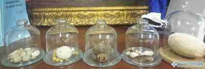 Женщины с повышенным риском образования камней в почках, посещение неотложной помощи