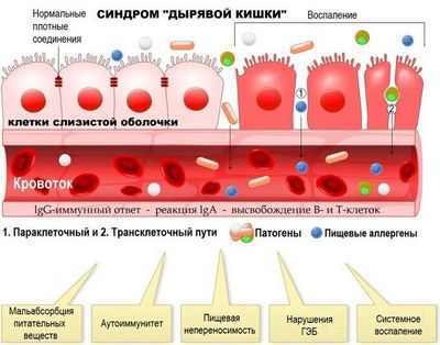Кишечные бактерии вызывают ожирение и нарушение обмена веществ у мышей с измененным иммунитетом