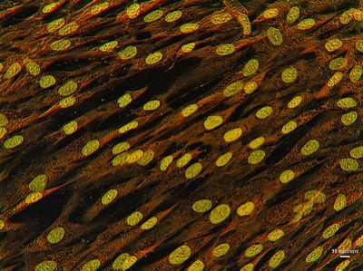Костный гормон подавляет аппетит у мышей
