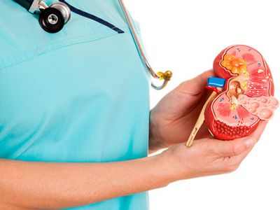 Вопросы и ответы: снижение риска образования камней в почках